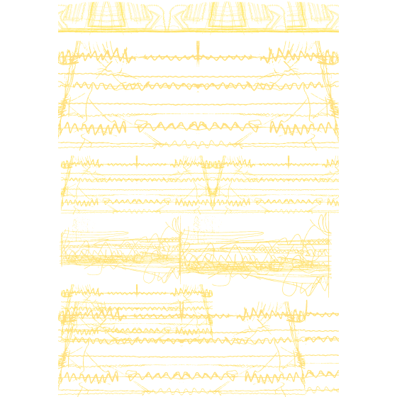 TRANSFER METALICO 040
